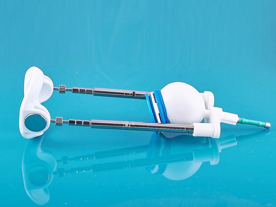 Ұзартқыш ligamentotomy нәтижесін жақсартуға көмектеседі